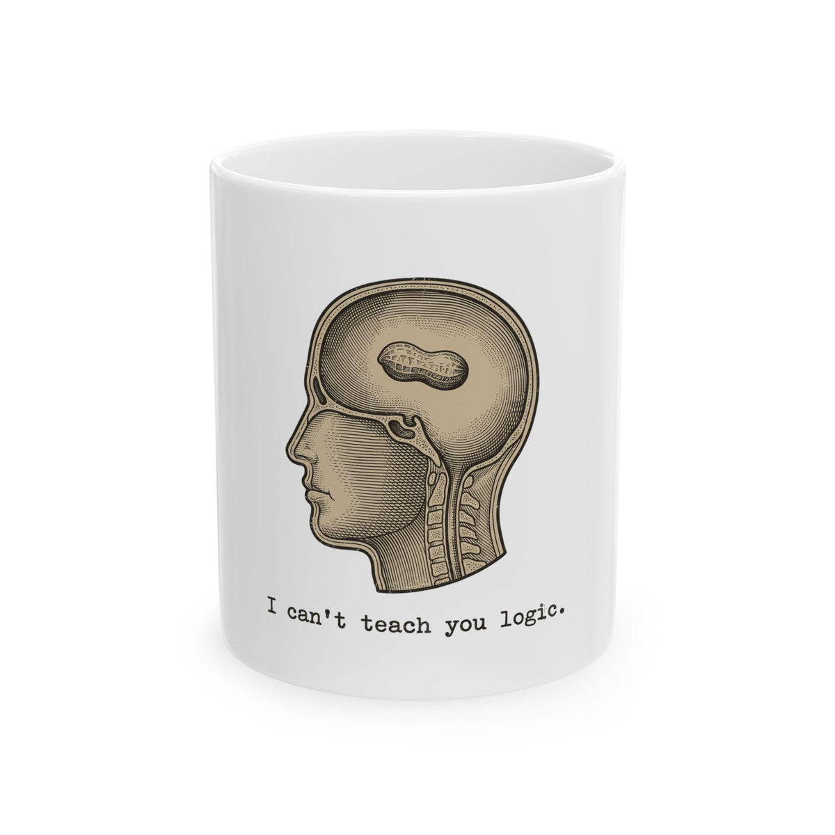 Peanut Brain Diagram